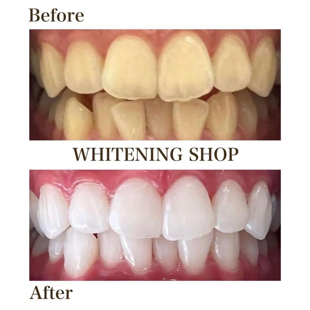 【ビフォーアフター】