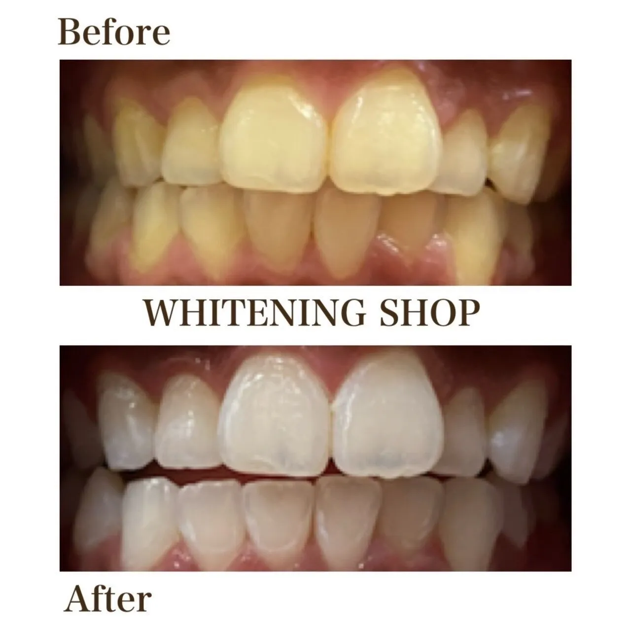 【ビフォーアフター】