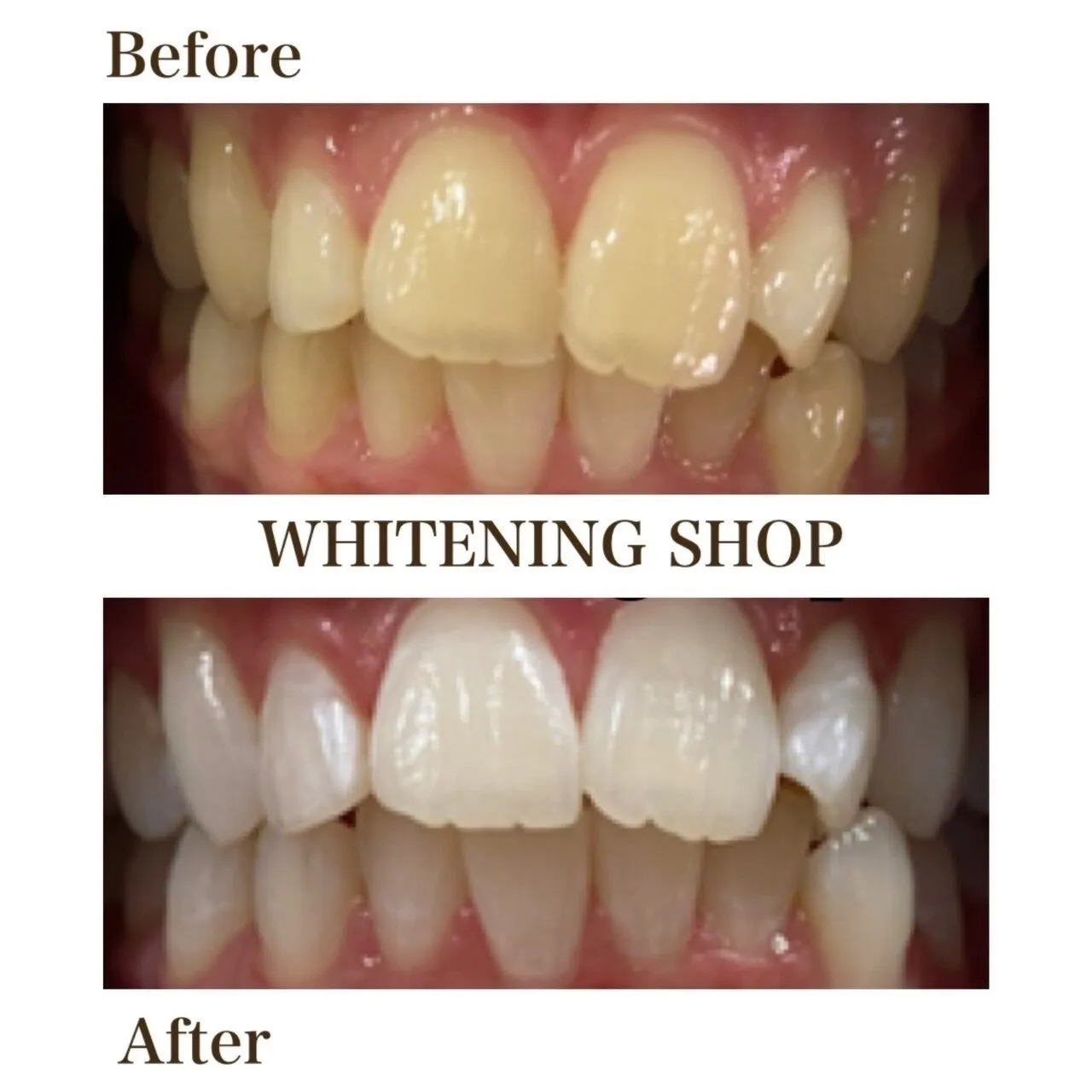 【ビフォーアフター】