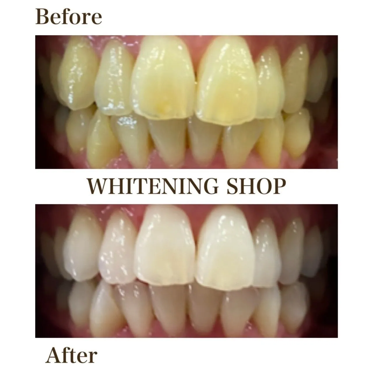 【ビフォーアフター】