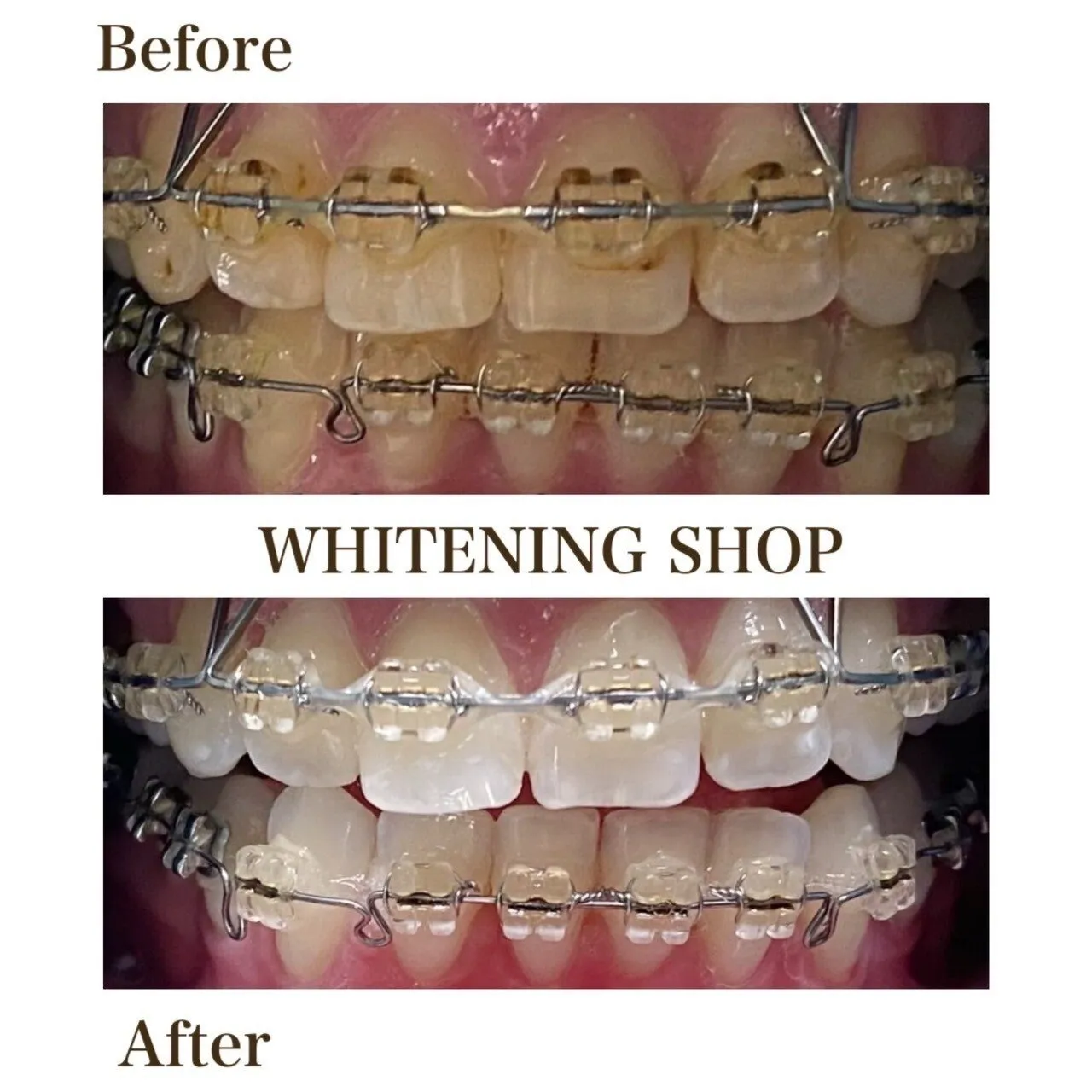 【ビフォーアフター】