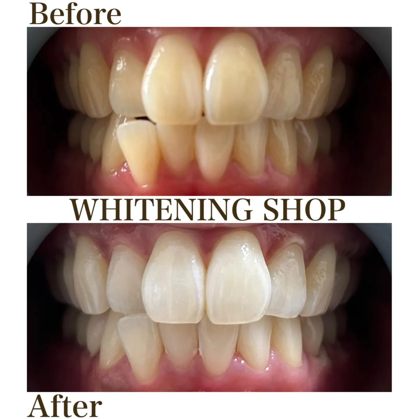 🌸春は“笑顔の印象”が変わる季節✨