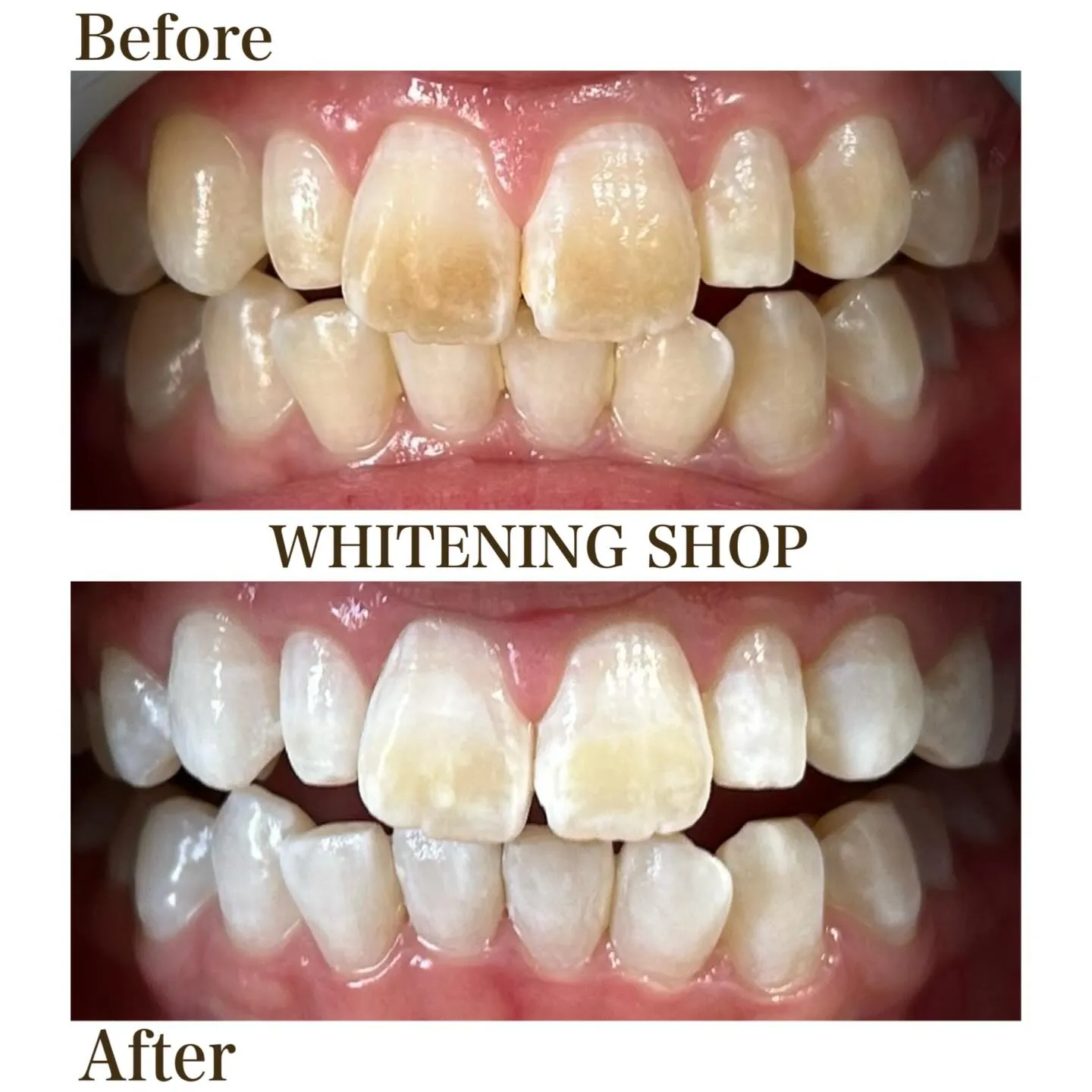 笑顔に、自信という輝きを💖